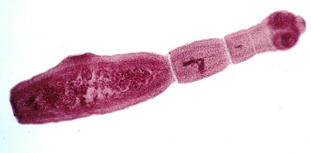 Echinococcus